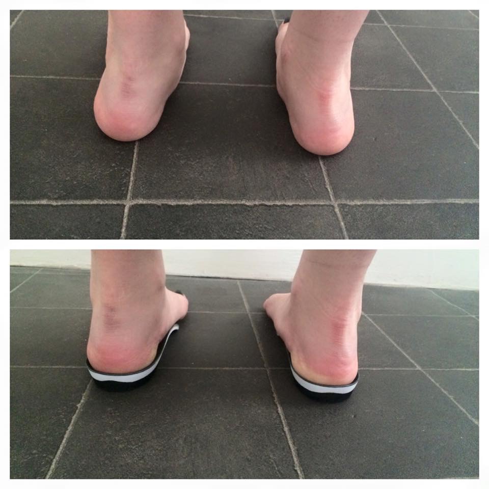 Insoles & Orthotics Kent Foot & Ankle Clinic